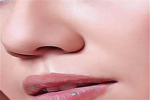 大连爱德丽格假体隆鼻怎么样