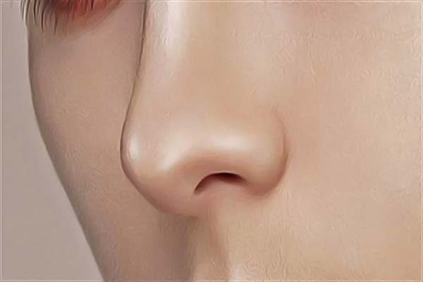 广州美恩双眼皮修复怎么样