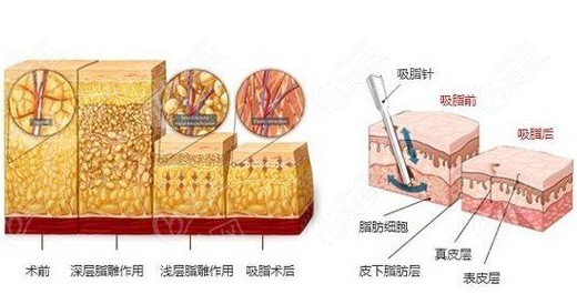 福州爱美尔医院美容整形科