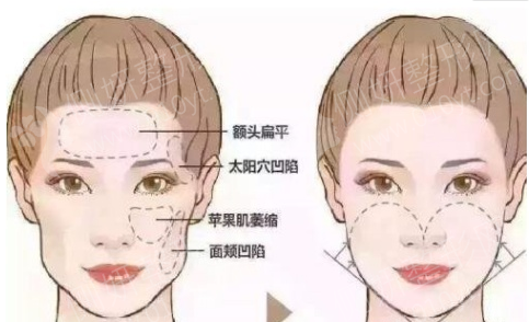 港大医院美容整形科