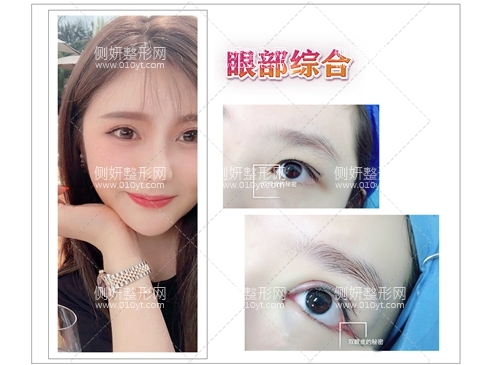 广西区医院美容整形科