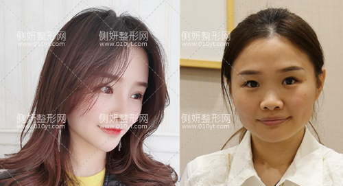 深圳鹏程整形科