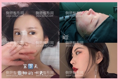 广东院附属整形科