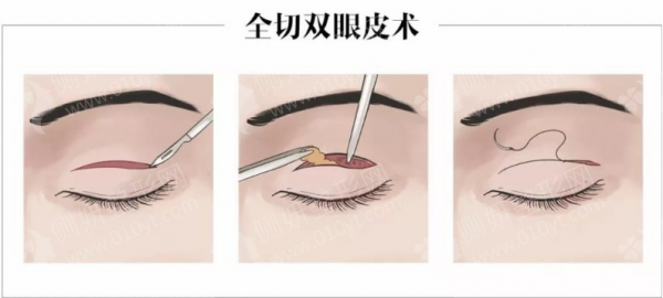 苏北医院整形科