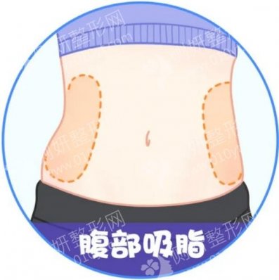 广州ot整形医院怎么样呢?