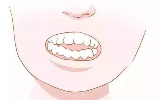 营口瑞宁口腔贵不贵