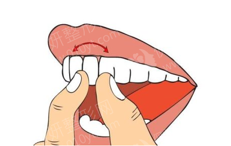 宁波拜博口腔医院好吗