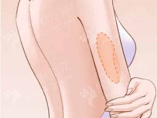 禾丽整形医院排名如何
