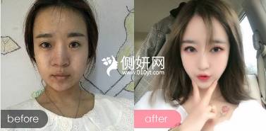 成都圣丽整容医院