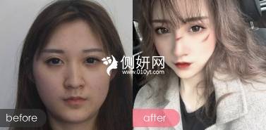 西安逆时光医疗美容医院怎么样