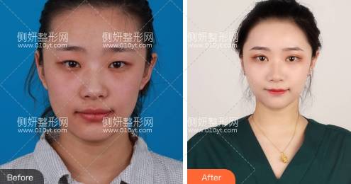 丹东金澄美容医院价格表