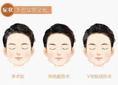 盛京医院王宇令
