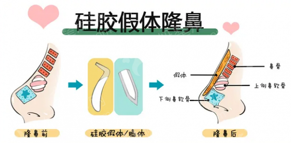 禾美嘉整形医院正规么