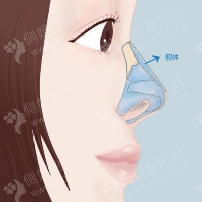 哈尔滨医大二院整形美容科