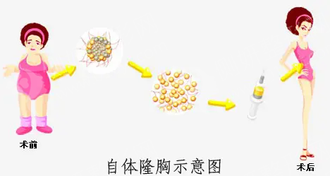 华西整形美容科需要挂号吗