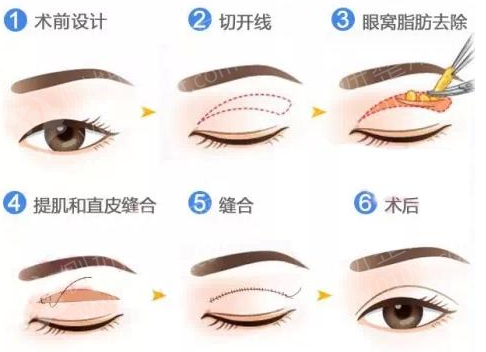 协和医院整形科专家哪个好