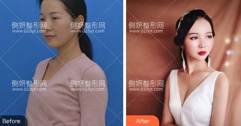 上海瑞欧医疗美容专家水平怎么样
