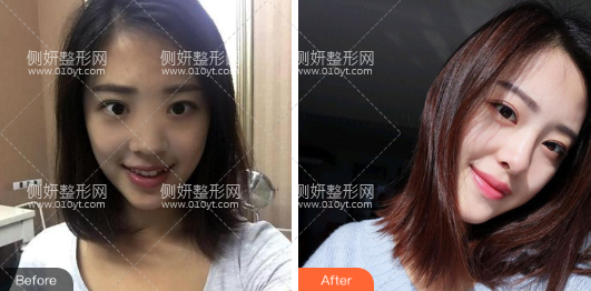 大连新华医院整形科怎么样