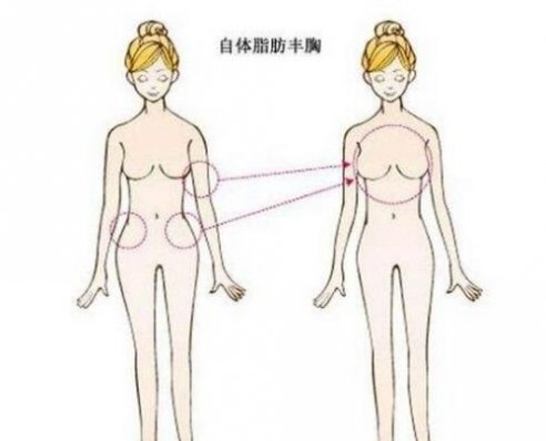 石家庄美联臣整形医院正规吗