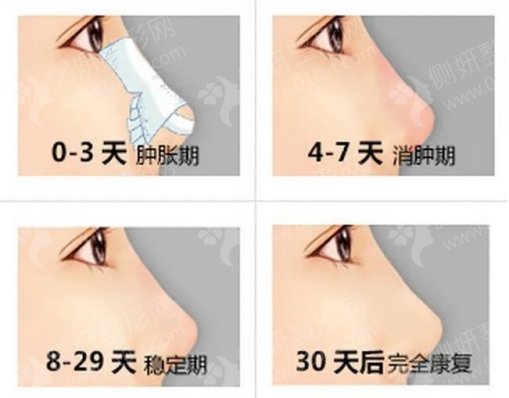 哈医大二院任丽虹