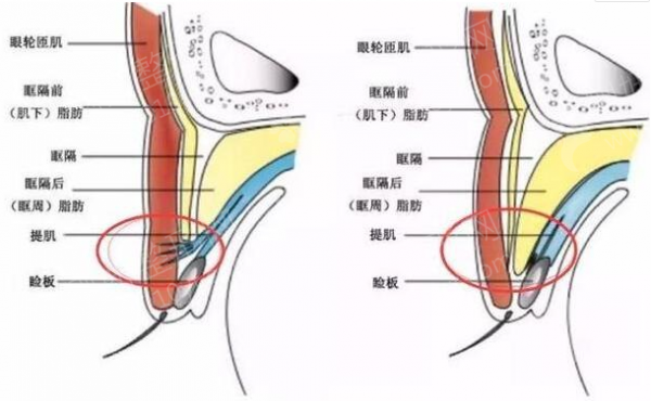 西南医院美容整形科价目表