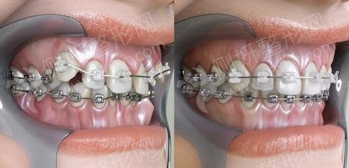 齐美口腔医院怎么样