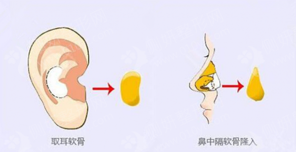 南充阿蓝整形医院怎么样?