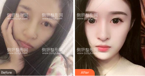 北京大学第三医院美容中心怎么样呢