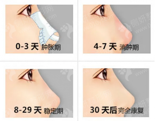 北医三院整形比较好的医生