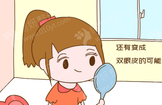 北京301美容科双眼皮怎么样
