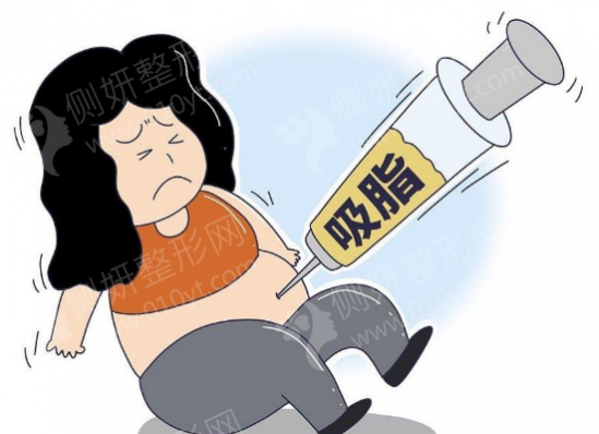 上海长海医院腰腹吸脂
