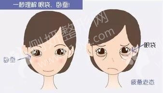铁岭市开原中医医院硅胶隆鼻
