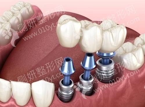 烟台孙周口腔门诊部牙齿矫正