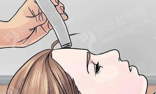 上海虹桥医院疤痕疗诊中心假体隆鼻