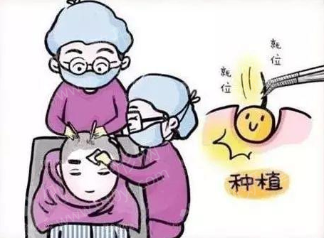 深圳丽格植发医院疤痕植发