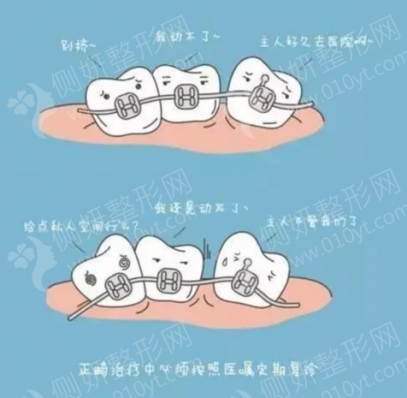 中日友好医院牙齿矫正