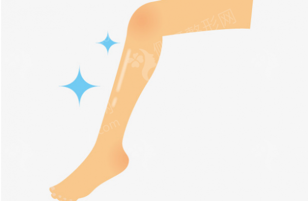 中日友好医院大腿吸脂