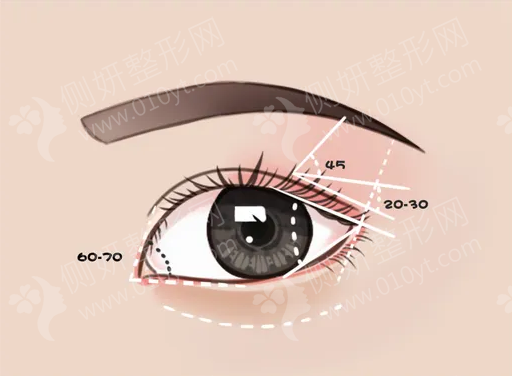 兰州眼综合整形医院