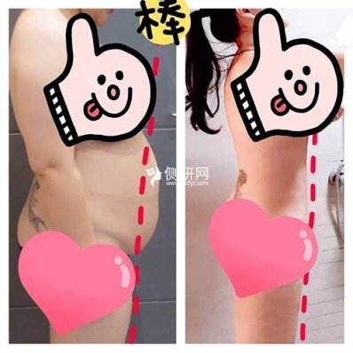 深圳北大医院抽脂减肥