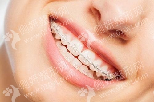 珠江医院口腔科牙齿种植