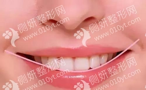 邢台市人民医院口腔科牙齿种植