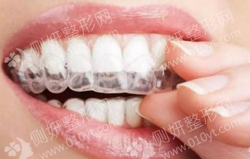 郑州大学第一附属医院口腔科牙齿矫正