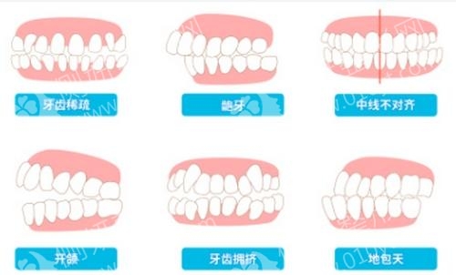 西安美立方口腔医院牙齿矫正