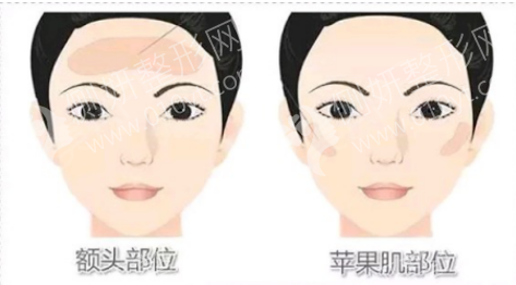 上海长征医院整形科假体隆胸