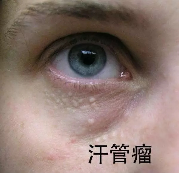 北京维林整形医院的口碑如何？（真实患者经验